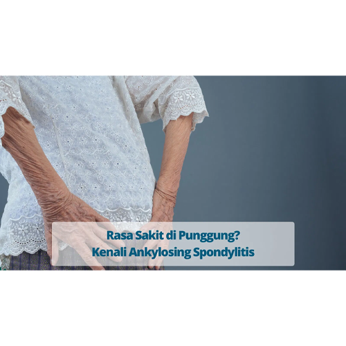 Ankylosing Spondylitis